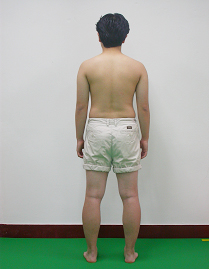 능동 요추 신전 검사